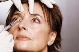  It does take time for the Botox to get absorbed and to relax the muscle, so you won’t see results right away. You’ll start noticing a difference within a few days and results will peak by about 10 to 14 days.  The body slowly metabolizes the product, meaning its effects gradually wear off over the course of three to four months. A recommended injection regimen of three times a year will better maintain the results of the treatment and  benefit wrinkle prevention.  It’s also important to keep in mind that i