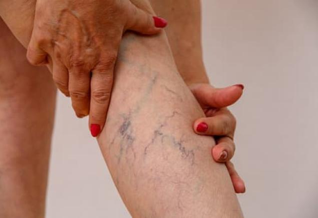 Sclerotherapy Workshops Offer Precision Training