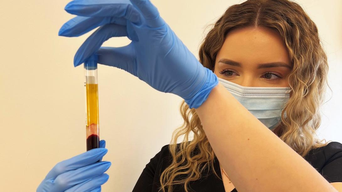 PRP uses the patients own blood for skin rejuvenation